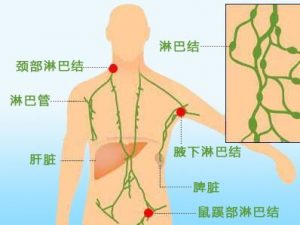 慢性淋巴細胞白血病的依魯替尼耐藥突變